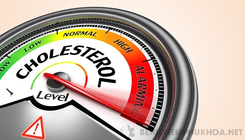 Nồng độ cholesterol sẽ được xác định thông qua xét nghiệm máu