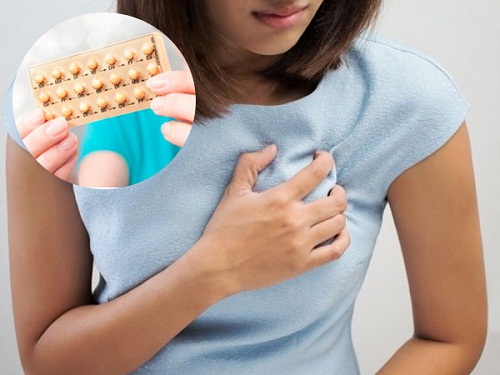 Dùng thuốc tránh thai có thể dẫn đến đau tức ngực và buồn nôn