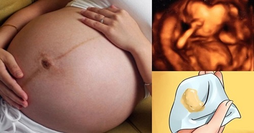 Khí hư dấu hiệu mang thai giúp nhận biết mang thai sớm