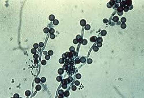 Nấm Candida albicans là gì?