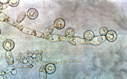Hình ảnh nấm Candida albicans