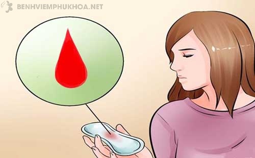 biểu hiện polyp cổ tử cung - chảy máu âm đạo