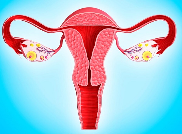 U nang buồng trứng di căn xuất hiện ở giai đoạn 3 của ung thư buồng trứng