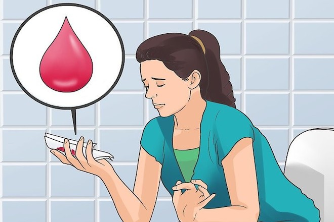 Viêm âm đạo ra máu phải làm sao?